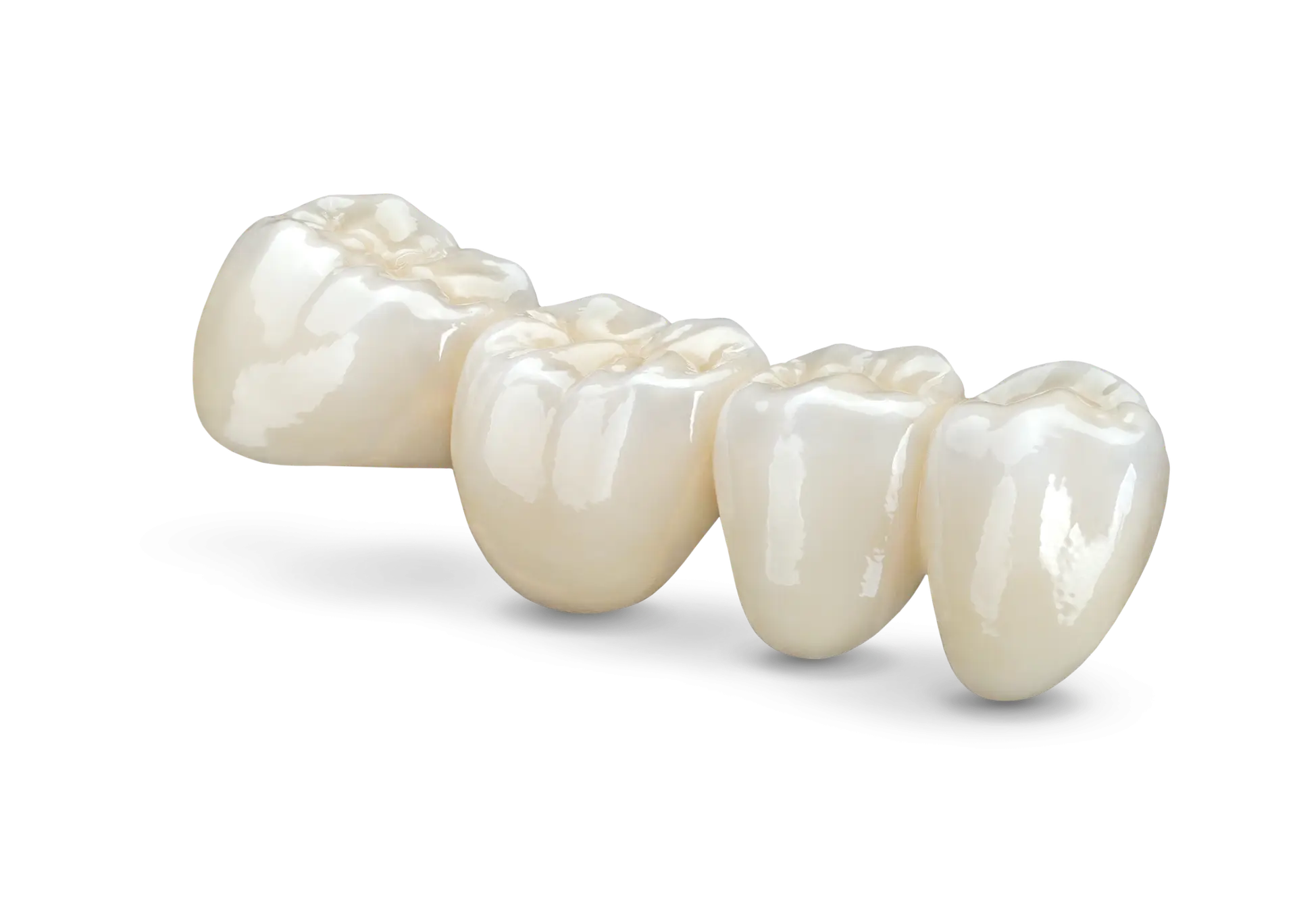 BruxZir full-strength crown and bridge used for durable and aesthetic tooth restoration