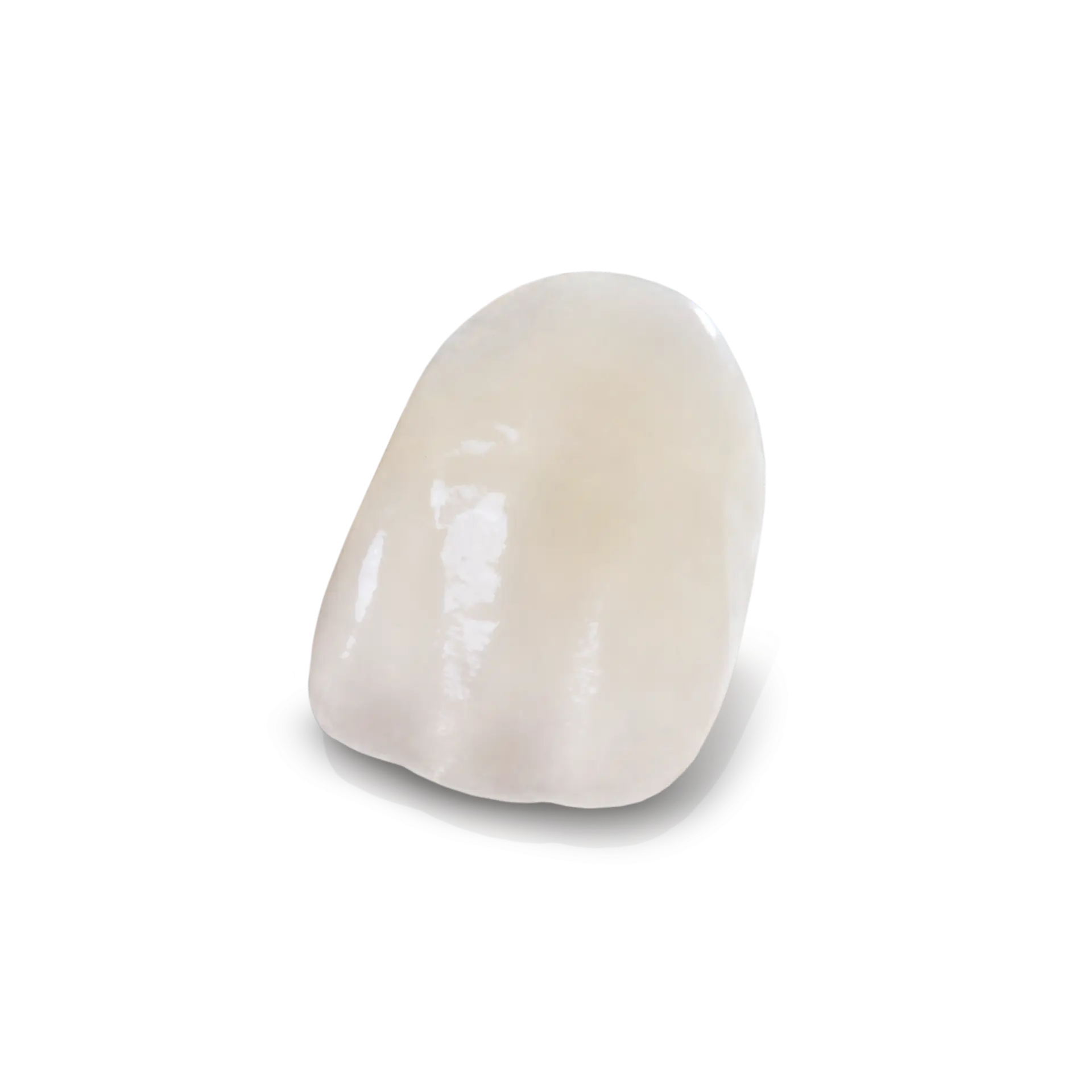 Emax dental restoration used for precise, aesthetic, and durable tooth reconstruction