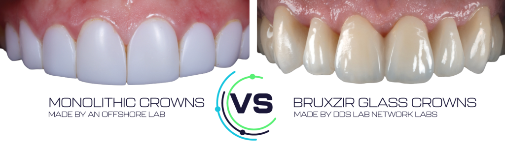 BruxZir Glass Comparison